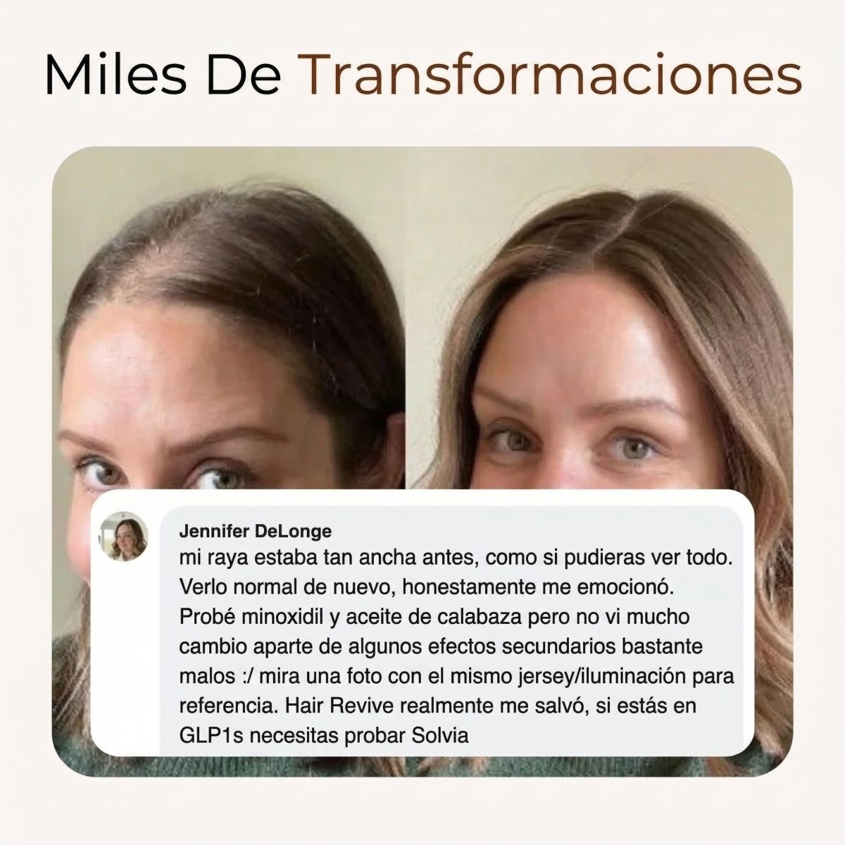 Detén la Caída de Cabello por GLP-1 y Recupera Tu Confianza