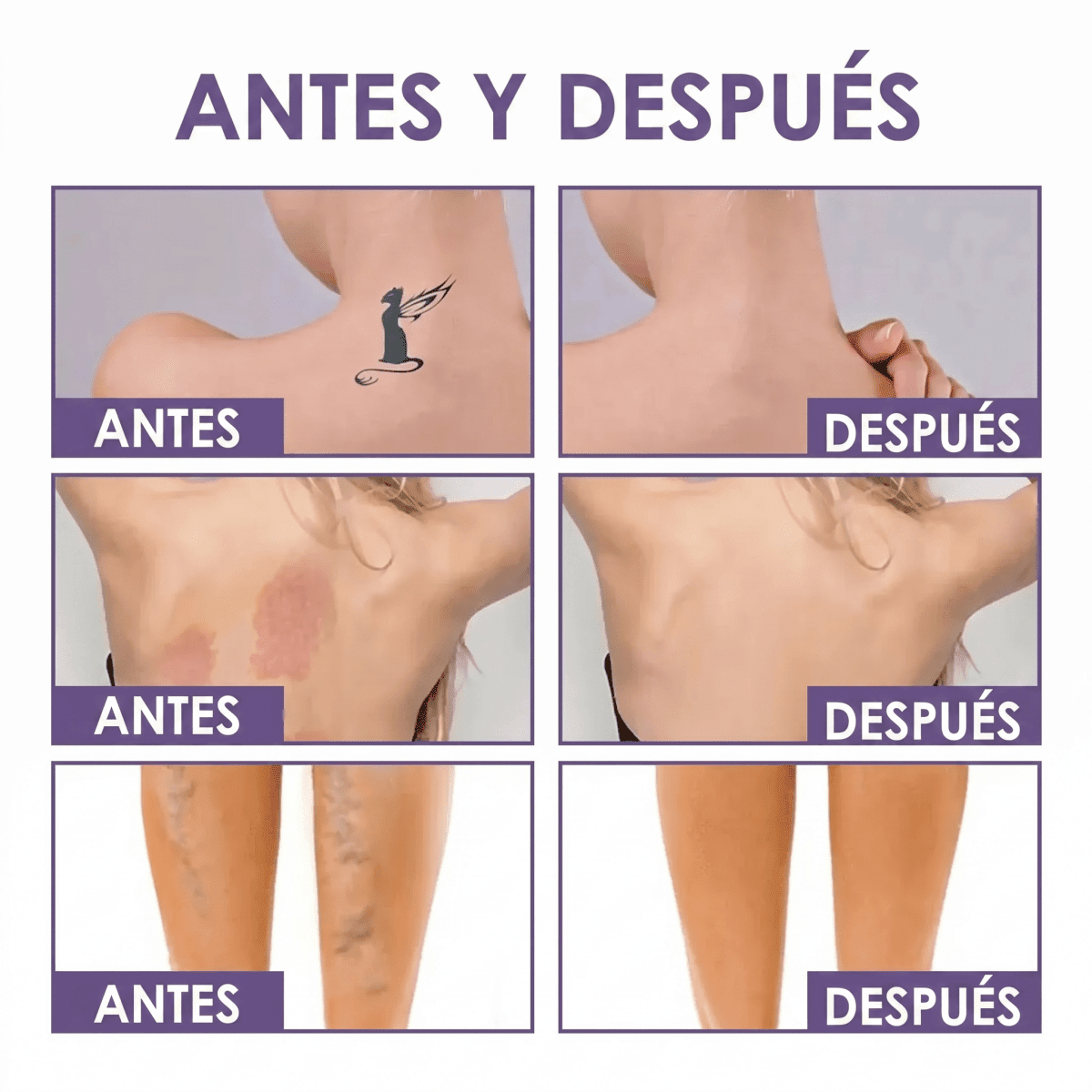 Perfeccionador Corporal