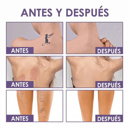 Perfeccionador Corporal