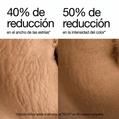 Redefiniendo la crema para estrías