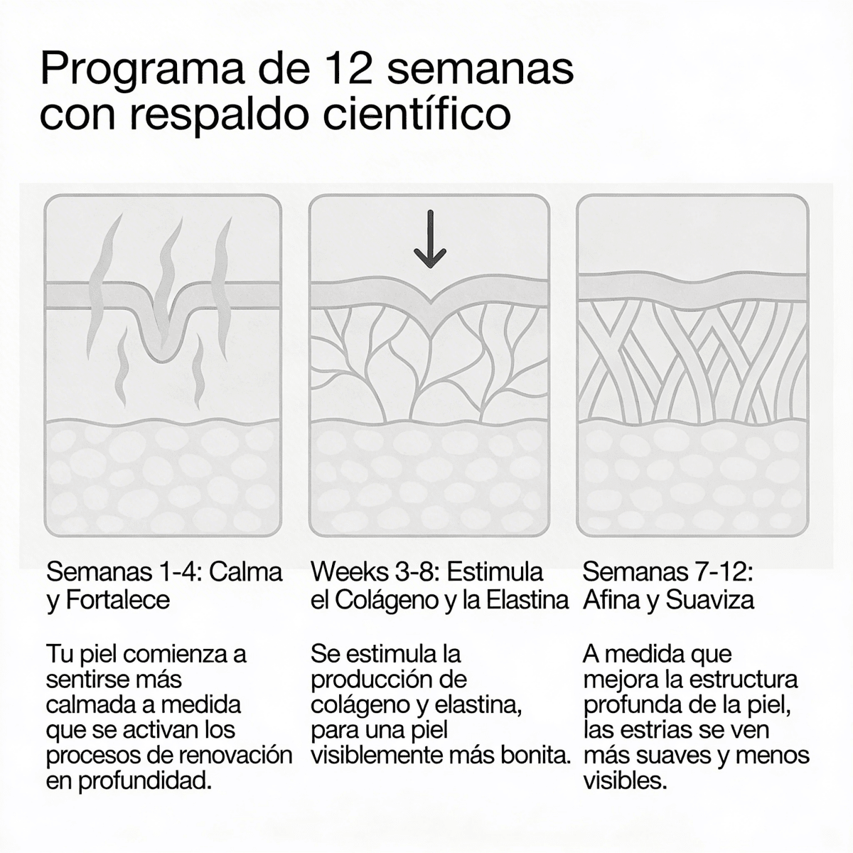 Redefiniendo la crema para estrías