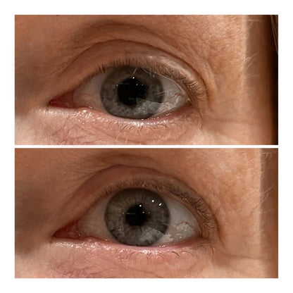 VARITA LIFTING DE OJOS