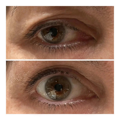 VARITA LIFTING DE OJOS