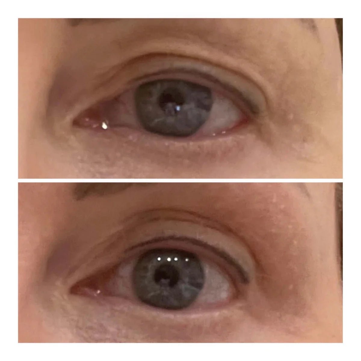 VARITA LIFTING DE OJOS