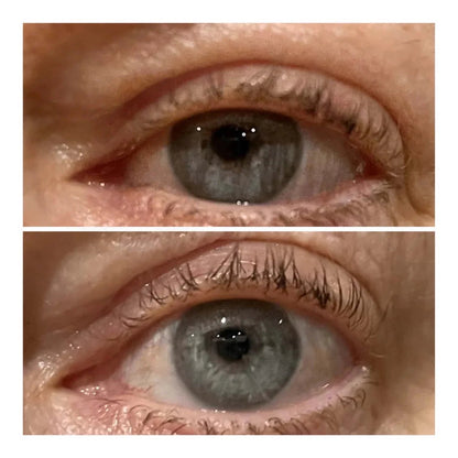 VARITA LIFTING DE OJOS